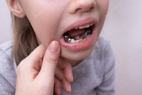 小児歯科で診療を受ける子どものイメージ