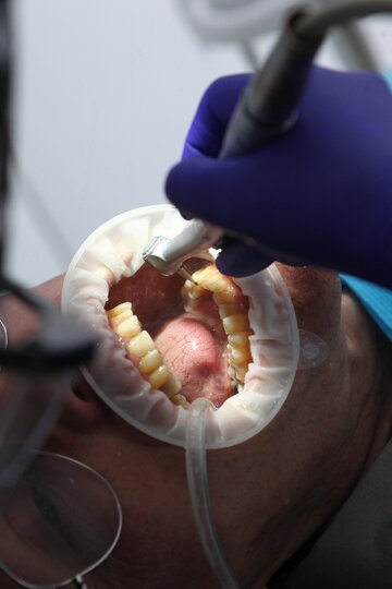 口腔外バキューム装置のイメージ